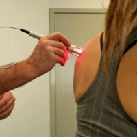 K-Laser-Shoulder-Treatment-min-353x353x0x0x353x353x1581678820