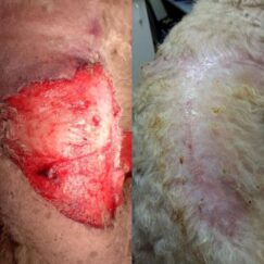 K-Laser-Wound-Healing-291x243x24x0x243x243x1583103722 (1)